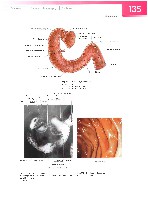 Sobotta  Atlas of Human Anatomy  Trunk, Viscera,Lower Limb Volume2 2006, page 142